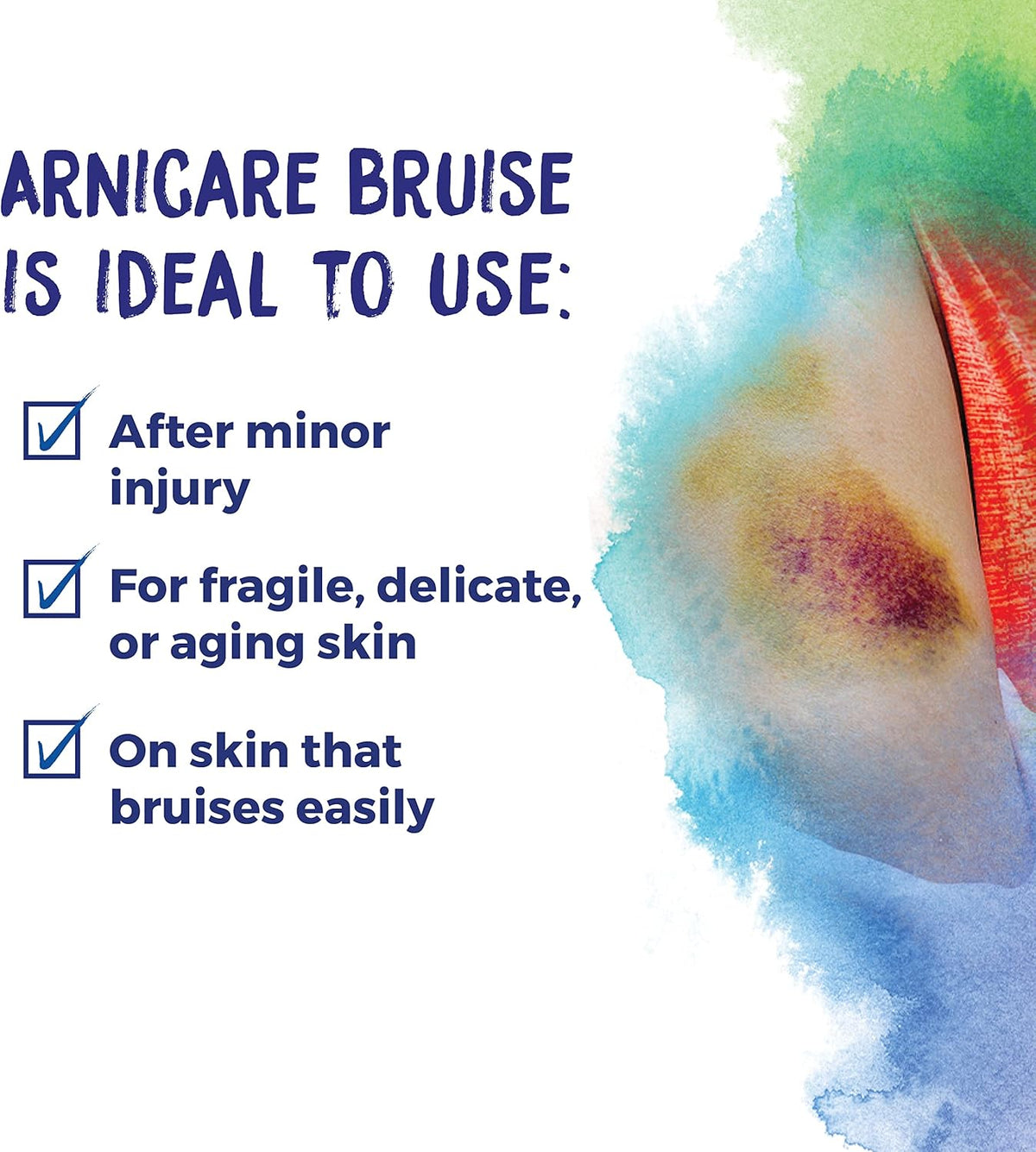 Boiron Arnicare Bruise Cream Homeopathic Medicine For Bruise Relief - 1.4 oz Cream